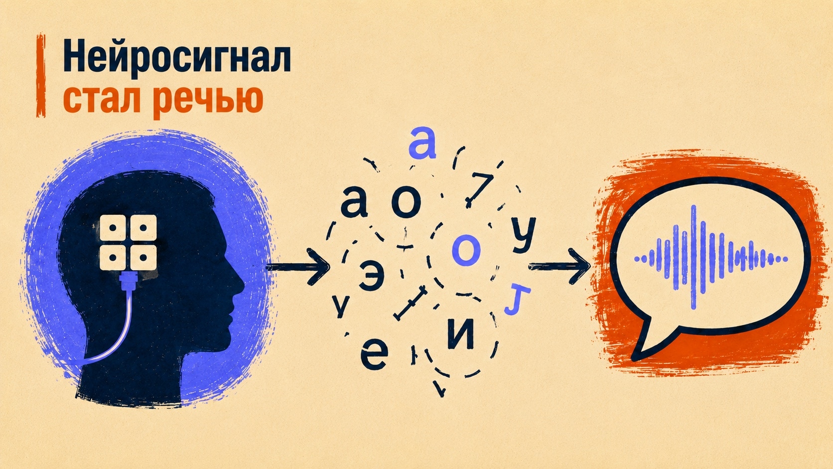 3800 часов с нейроимплантом: как пациент с БАС превратил эксперимент в рабочий средство